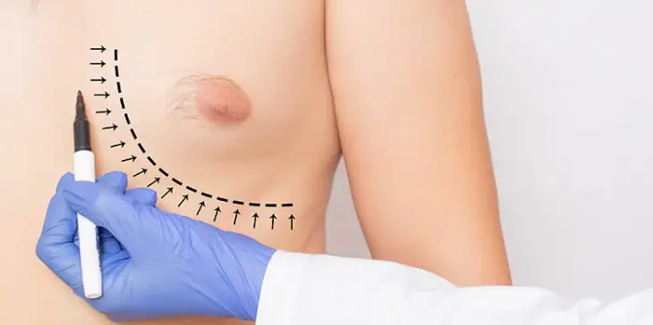 Breast Care